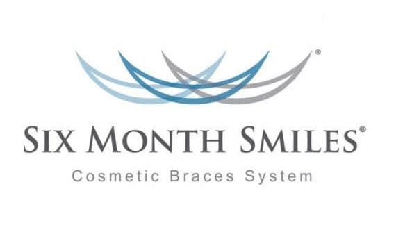 Six Month Smiles is a clear brace treatment that gives you a smile makeover without the need to wear unsightly metal braces